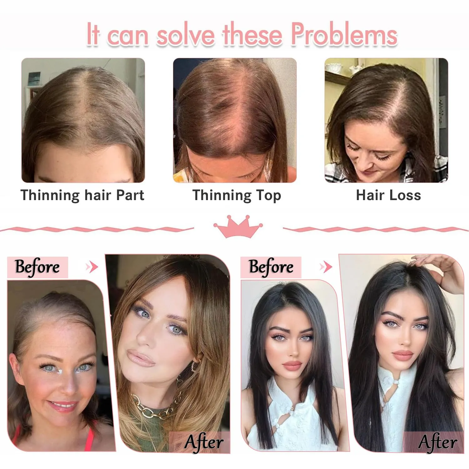 14 Inch Hair Toppers for Women Toppers Hairpieces for Women Wiglets Hairpieces for Thinning Hair Topper Synthetic Hairpiece Wig Toppers with Thinning hair