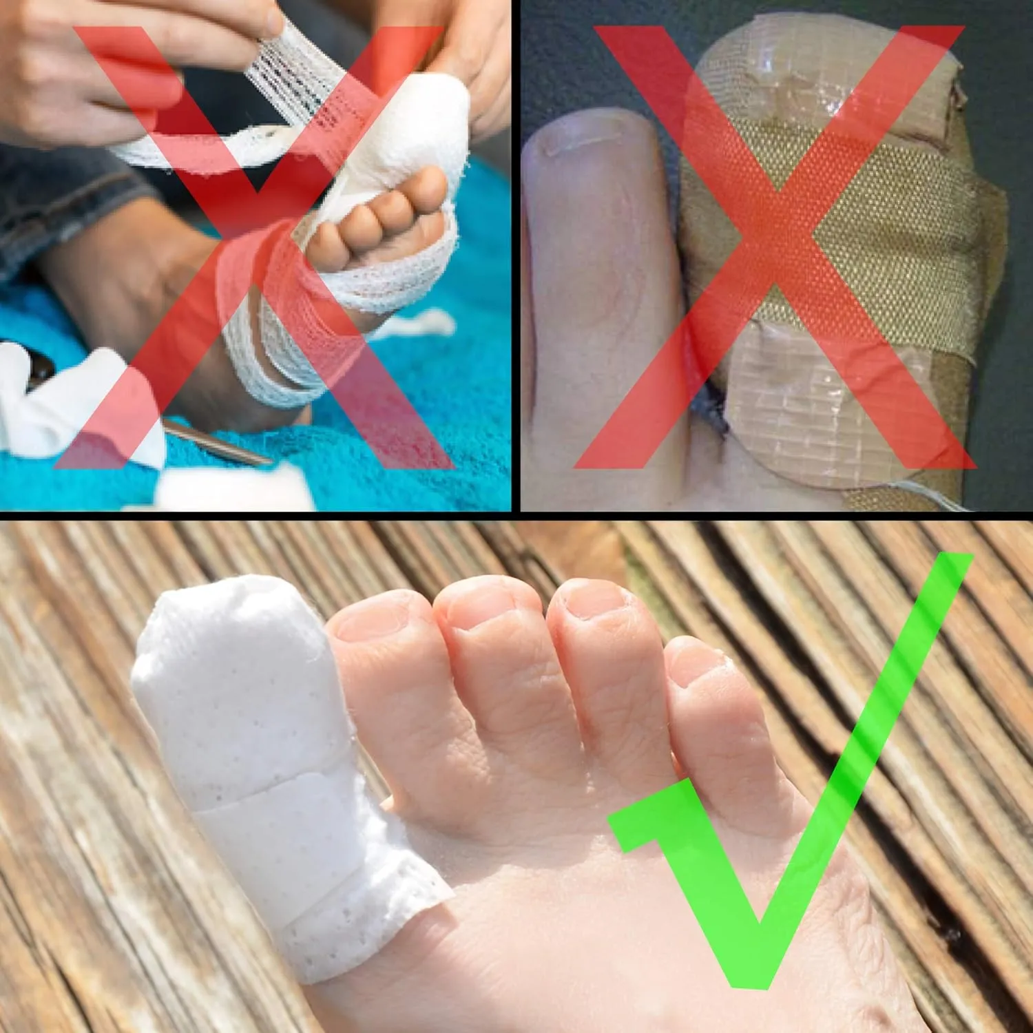 MediMitt ToeMitt Big Toe Bandages Non-Adhesive (Full Coverage Big Toe Bandage) (Without Absorbent Pad, Small (Pack of 10))